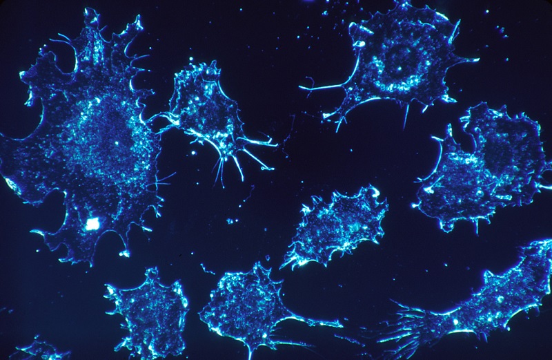 A group of scientists is taking the first steps to find a universal cancer vaccine