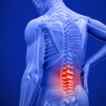 Back pain